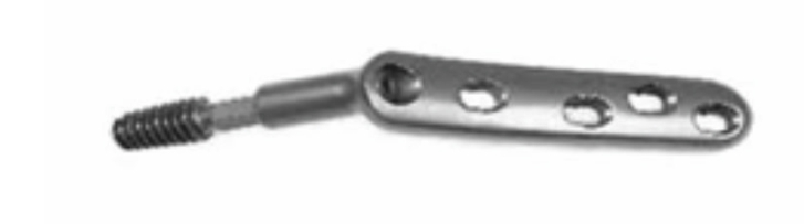 Кутова блокуюча пластина UMP